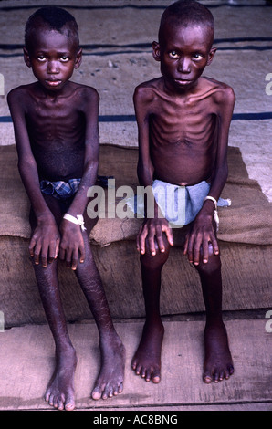 Africa Sierra Leone 1999 Opfer des Krieges unterernährten jungen Stockfoto