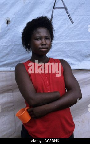 Africa Sierra Leone 1999 Opfer des Krieges Amputierte Camp für diejenigen, deren Gliedmaßen böswillig abgehackt wurden Stockfoto