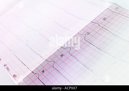 ECG-Bericht Stockfoto