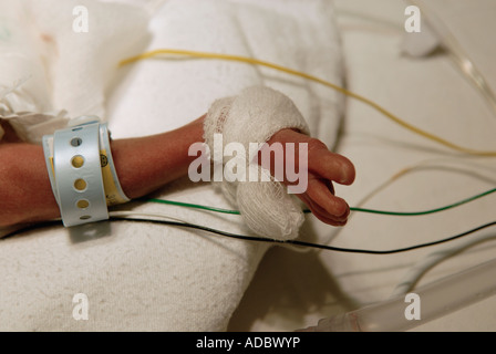 Pulsoximeter vorzeitige Säugling Fuß auf neonatale Intensivstation befestigt Stockfoto