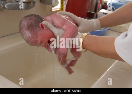 Neugeborenes Baby wird auf der Entbindungsstation des Bikur Cholim Krankenhauses, einer Zweigstelle des Shaare Zedek Medical Center, in Jerusalem, Israel, gewaschen Stockfoto