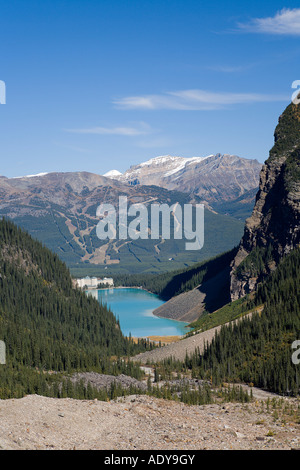 Lake Louise, Banff Nationalpark, Alberta, Kanada Stockfoto