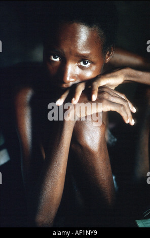 Namibia, leidet Frau AIDS HIV Immunschwäche-Krankheit Stockfoto