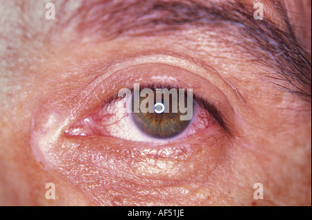 Nahaufnahme eines Mannes Auge Stockfoto
