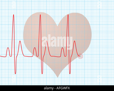 Medizinischer abstrakten Hintergrund zeigt eine EKG-Herz schlagen über eine technische Raster Stockfoto