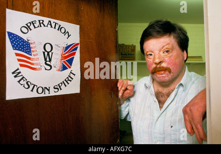 Simon Weston Portrait Falklands Kriegsheld. 1988 Aufbau der Operation Weston Spirit, hier im Büro in Liverpool UK 1980er HOMER SYKES Stockfoto