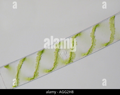 Spirogyra spec (Spirogyra spec.), in glänzend durch Licht, Kern sichtbar Stockfoto