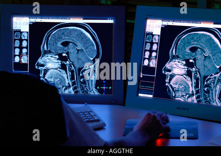 3D-Analyse eines menschlichen Gehirns mit MRT (Magnetresonanztomographie) Technik Stockfoto