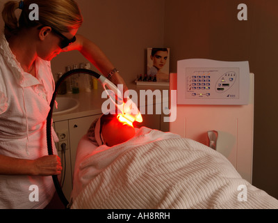 Entfernen überschüssigen Gesichtsbehaarung mit IPL-Behandlung intense pulsed light Stockfoto