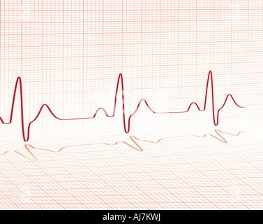Herzschlag rote Gitter gelegt über einen Hintergrund mit Platz für Ihren eigenen text Stockfoto