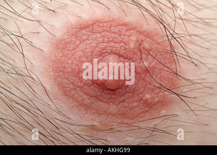 Mans Brustwarze, Close Up. Stockfoto