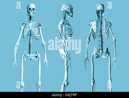 Skelett Skelette verschiedene Ansichten Skelette Gegenspieler Ansichten Stockfoto