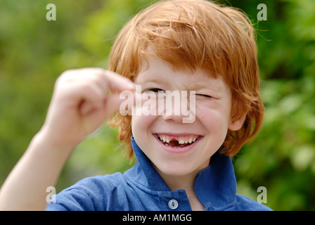 Junge mit einer Zahnlücke Lücke verliert seine Milchzähne Milchzähne Milch Stockfoto