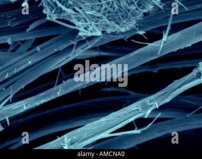 SEM - Asbest-Fasern Stockfoto