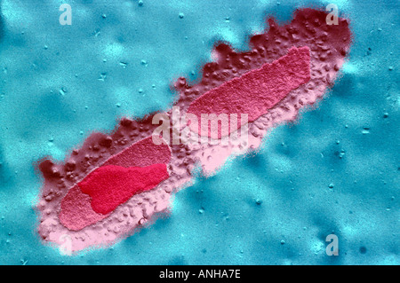 Escherichia Coli (e Coli) Elektron Schliffbild SEM von e-coli A-Gram-negativen Bakterien