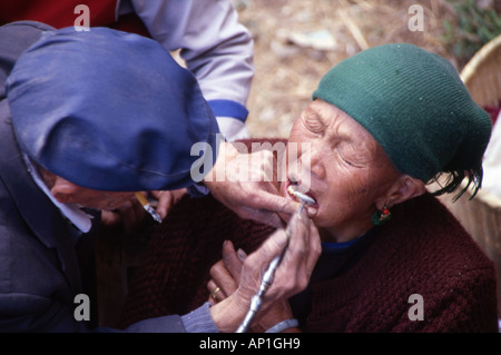 örtlichen Zahnarzt arbeitet an einem lokalen Womans Zähne Gestaltung Markt Yunnan Provinz china Stockfoto