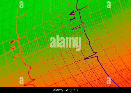 EKG Elektrokardiogramm Closeup View-Konzept Stockfoto