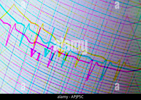 EKG Elektrokardiogramm Closeup View-Konzept Stockfoto