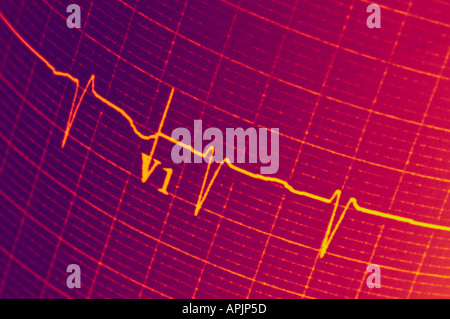 EKG Elektrokardiogramm Closeup View-Konzept Stockfoto