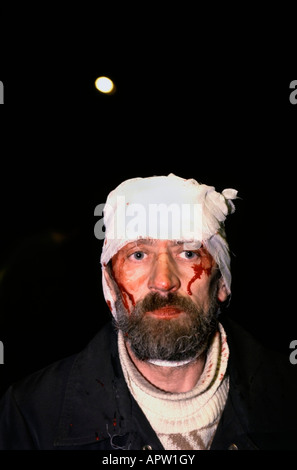 1993 russische Verfassungskrise. Verwundeter russischer Zivilist außerhalb des Fernsehsenders Ostankino, Anti-Jelzin Putsch in Moskau, Russland. Stockfoto