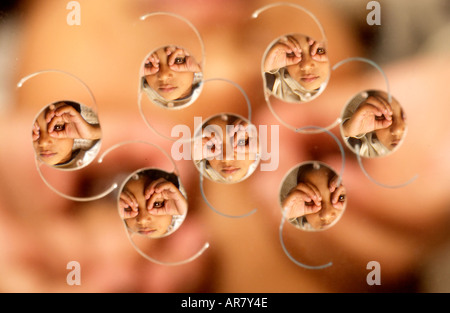 Bangladeshi Kind mit Anblick speichern Linsen verwendet durch die Sightsavers Nächstenliebe für die Kataraktchirurgie in der dritten Welt. Stockfoto