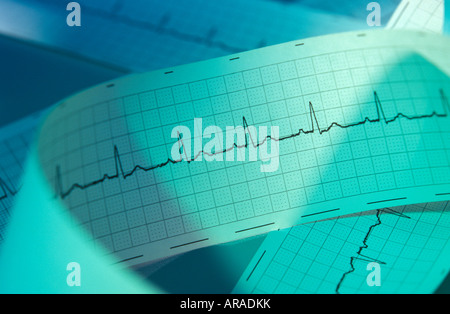 ECG Stockfoto