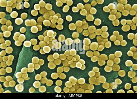 Dieser Scan Elektron Schliffbild (SEM) zeigt zahlreiche Klumpen von Methicillin-resistenten Staphylococcus Aureus-Bakterien Stockfoto