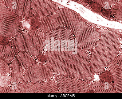 Eine Transmission Electron Schliffbild (TEM) des skelettartigen Muskels im Querschnitt. Stockfoto
