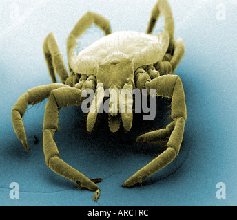 Ein scanning Electron Schliffbild (SEM) von das Rotwildhäckchen (Ixodes Dammini), vergrößert, X20. Dies ist der Vektor der Lyme-Borreliose Stockfoto