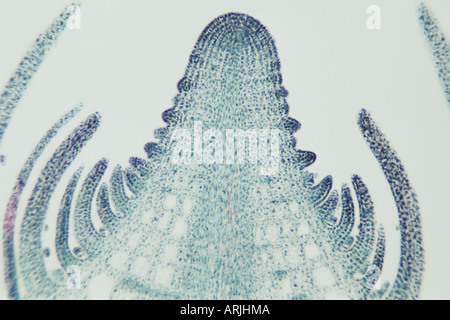 Mare's-Tail, gemeinsame Mare's-tail (Hippuris Vulgaris), mikroskopische foto Stockfoto