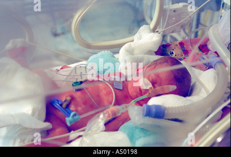 eine Neugeborene in einer Intensivstation Stockfoto