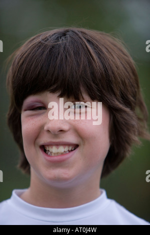 Junge boy10-11 verletzt spielen baseball Stockfoto