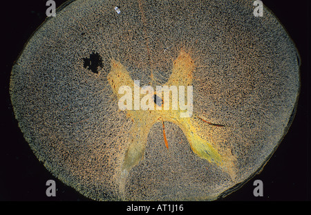 Multipolare Neuron der spinalen Cordon Nervengewebe 7 X Stockfoto