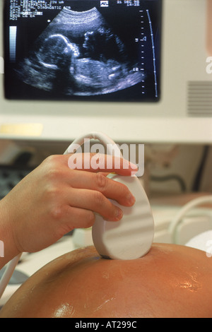 Hand-held-Sonde auf schwangere Frau während der Ultraschall-Test mit 5-6 Monate alten Fötus auf dem Bildschirm Stockfoto