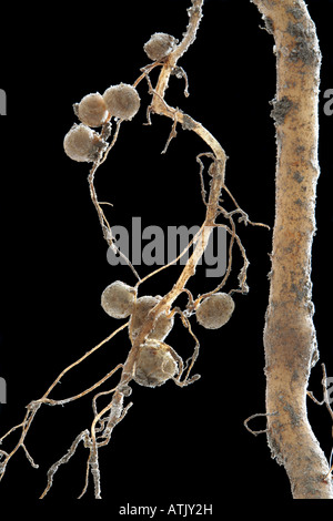 Knötchen auf Wurzeln der Gartenbohne (Phaseolus Vulgaris) Stockfoto