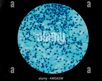 Sperma, acrosomal, beflecken Integrität Akrosom unter Mikroskopie auf 100 X inmersion Öl objetive Stockfoto