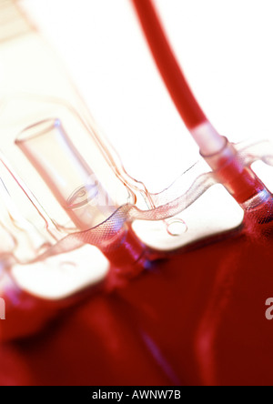 IV-Tropf-Tasche mit Blut, close-up Stockfoto