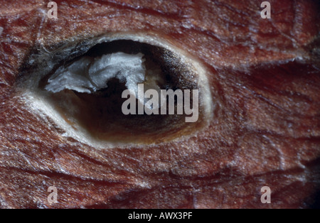 Rinderbandwurm (Taenia Saginata), aufgedeckt cysticercus Stockfoto