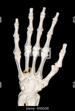 Kunststoff Skeletthand mit einem Ehering auf schwarzem Hintergrund Stockfoto