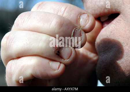 Mann seine Nägel beißen Stockfoto