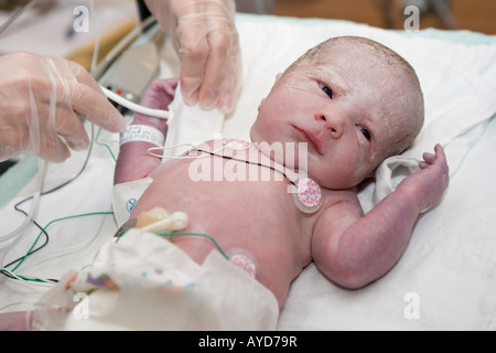 Ein Frühgeborenes 5 Wochen wird betreut von Neonatality Krankenschwestern Minuten genommen nach geboren Stockfoto