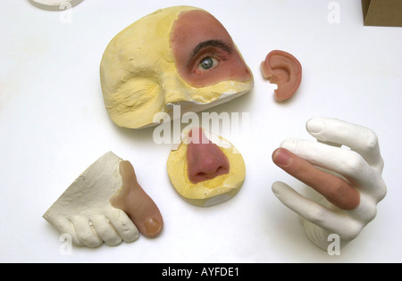 MKG-Labor zeigen Nase Ohr Auge und Finger Rekonstruktion UK Stockfoto