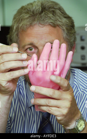 Gesichtschirurgie Labor zeigt eine Hand gegossen in Wachs UK Stockfoto