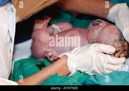 Amsterdam eine Frau einen gesunden jungen im Kreißsaal der Universitätsklinik VU gebärt Stockfoto