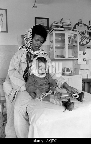 B/W einer Mutter mit ihrem jungen Kind an einer Polio-Rehabilitationsklink in Asmara, Eritrea Stockfoto