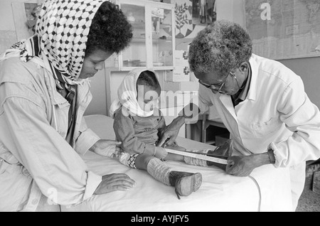 B/W eines Technikers, der die Beine eines jungen Kindes mit Polio für Zirkel in einer Rehaklinik misst. Asmara, Eritrea Stockfoto