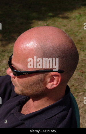 Erhöhte Ansicht von einem Mann mit einer Glatze und Sonnenbrille Stockfoto