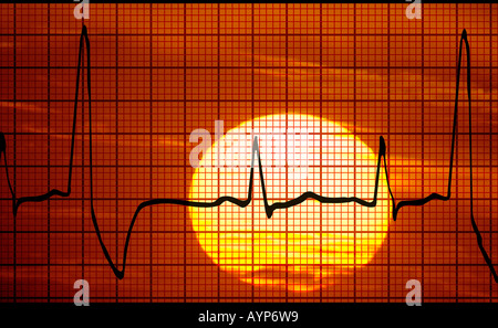 konzeptuelle Ansicht EKG Elektrokardiogramm Compositing über Sonnenuntergang Foto anzeigen Stockfoto