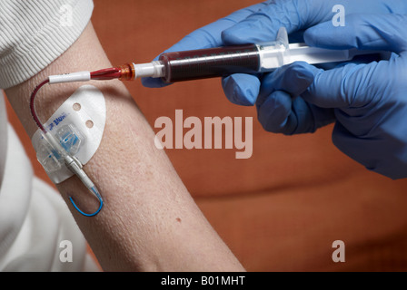 Blutentnahme aus einer Picc Linie mit OP-Handschuhen (peripher zentrale Katheter) Stockfoto