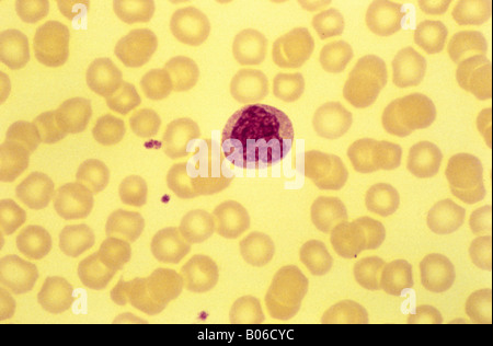 Monocyte weißer Blutkörperchen Stockfoto